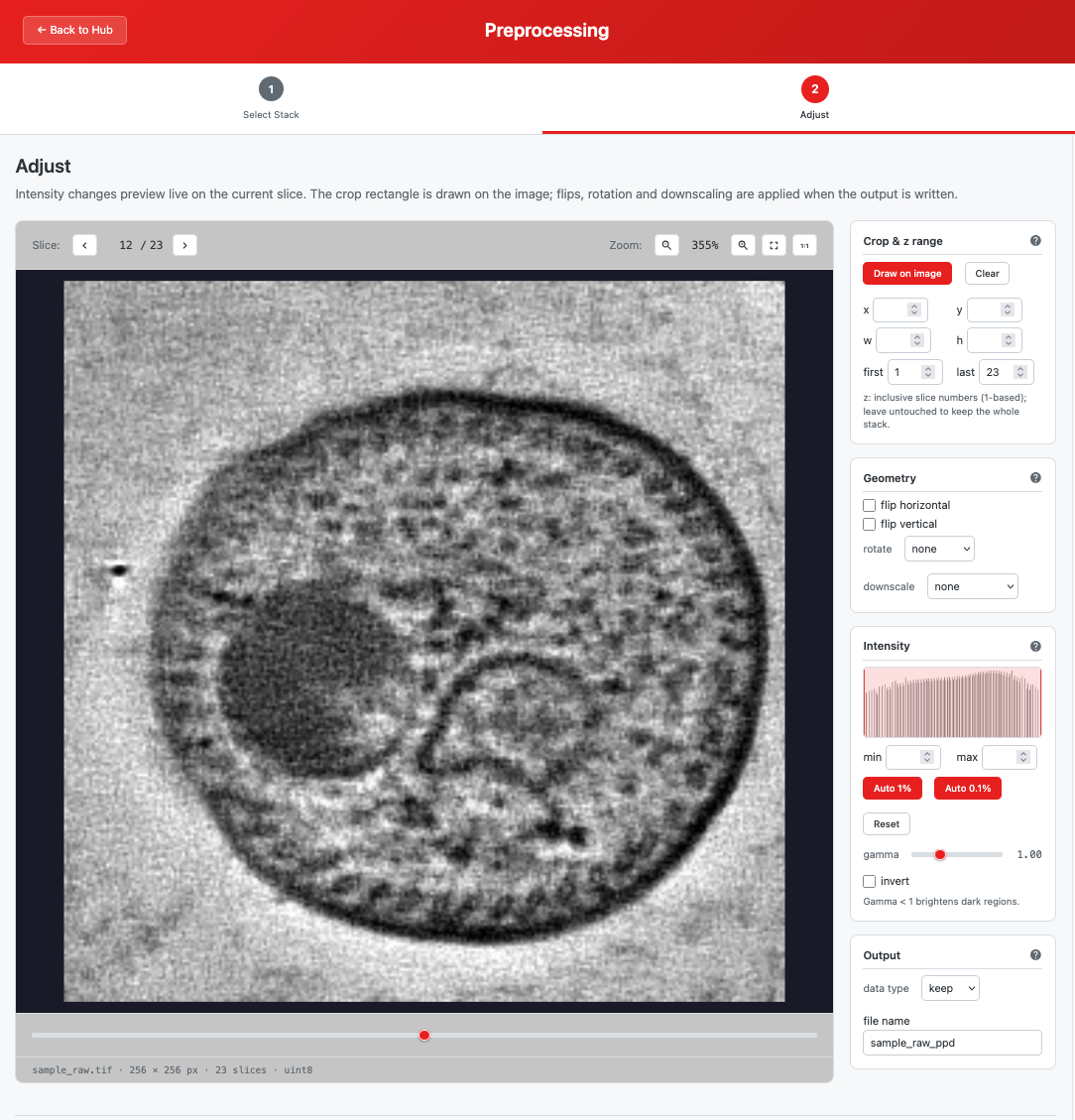 Adjust step with intensity histogram and window markers